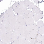 Immunohistochemical staining of human skeletal muscle shows no positivity in myocytes as expected.