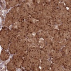 Anti-ZNF619 Antibody