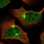 Immunofluorescent staining of human cell line U-2 OS shows localization to nucleoplasm & intermediate filaments.