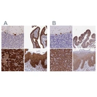 Anti-RPL8 Antibody
