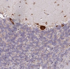 Immunohistochemical staining of human cerebellum shows strong cytoplasmic positivity in Purkinje cells.
