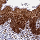 Immunohistochemical staining of human skin shows strong cytoplasmic positivity in squamous epithelial cells.