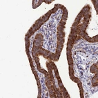 Immunohistochemical staining of human Fallopian tube shows strong cytoplasmic positivity in glandular cells.