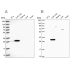 Western blot analysis using Anti-RPL8 antibody HPA045095 (A) shows similar pattern to independent antibody HPA050165 (B).