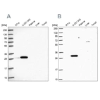Western blot analysis using Anti-RPL8 antibody HPA045095 (A) shows similar pattern to independent antibody HPA050165 (B).