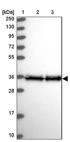Lane 1: Marker [kDa] 250, 130, 95, 72, 55, 36, 28, 17, 10_br/_Lane 2: Human cell line RT-4_br/_Lane 3: Human cell line U-251MG sp
