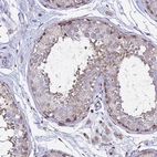 Immunohistochemical staining of human testis shows moderate cytoplasmic positivity in cells in seminiferous ducts.