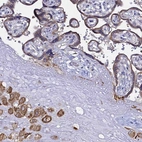 Immunohistochemical staining of human placenta shows moderate cytoplasmic positivity in trophoblastic cells.