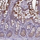 Immunohistochemical staining of human gastrointestinal shows strong cytoplasmic positivity in glandular cells.