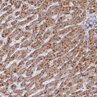 Anti-CCZ1 Antibody