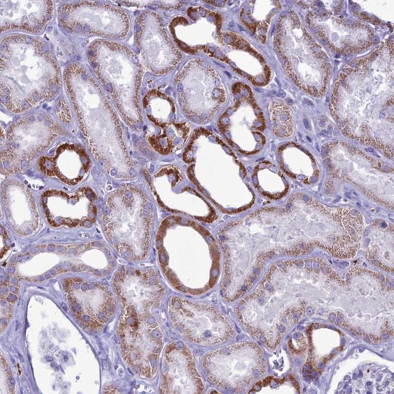 Anti-C21orf140 Antibody