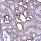 Anti-C21orf140 Antibody