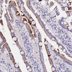 Anti-MS4A18 Antibody