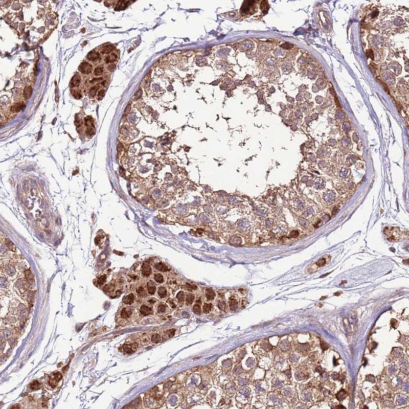 Anti-CCDC112 Antibody