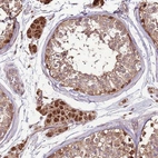 Anti-CCDC112 Antibody