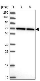 Lane 1: Marker [kDa] 250, 130, 95, 72, 55, 36, 28, 17, 10_br/_Lane 2: Human cell line RT-4_br/_Lane 3: Human cell line U-251MG sp