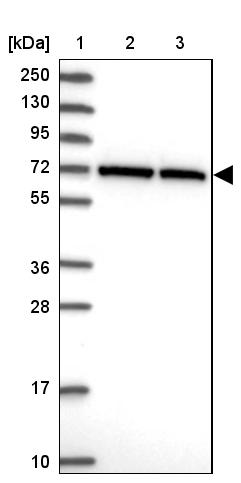 Anti-CCDC112 Antibody