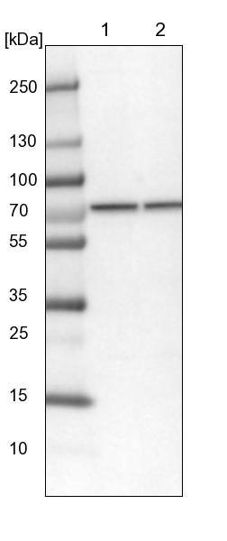 Anti-CCDC112 Antibody