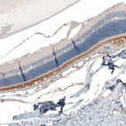 Immunohistochemical staining of rat eye shows strong cytoplasmic positivity in photoreceptor cells.