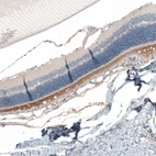 Immunohistochemical staining of rat eye shows strong cytoplasmic positivity in photoreceptor cells.