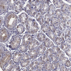 Immunohistochemical staining of human stomach shows weak cytoplasmic positivity in glandular cells.