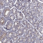 Immunohistochemical staining of human stomach shows weak cytoplasmic positivity in glandular cells.