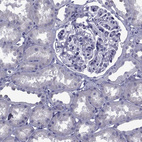 Immunohistochemical staining of human kidney shows no positivity in cells in tubules as expected.