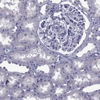 Immunohistochemical staining of human kidney shows no positivity in cells in tubules as expected.