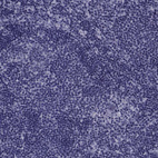 Immunohistochemical staining of human lymph node shows no positivity in non-germinal center cells as expected.