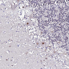 Anti-ACTL6B Antibody