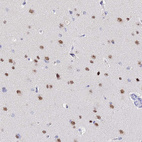 Immunohistochemical staining of human cerebral cortex shows moderate nuclear positivity in neurons.