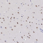 Immunohistochemical staining of human cerebral cortex shows moderate nuclear positivity in neurons.