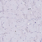 Immunohistochemical staining of human skeletal muscle shows no positivity in myocytes as expected.
