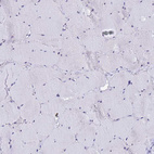 Anti-ACTL6B Antibody