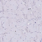 Immunohistochemical staining of human skeletal muscle shows no positivity in myocytes as expected.