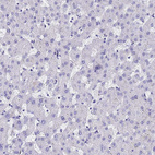 Anti-ACTL6B Antibody