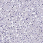 Immunohistochemical staining of human liver shows no positivity in hepatocytes as expected.