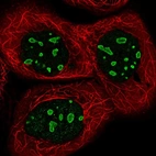 Immunofluorescent staining of human cell line A-431 shows localization to nucleoli.