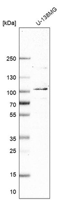 Anti-MCM8 Antibody