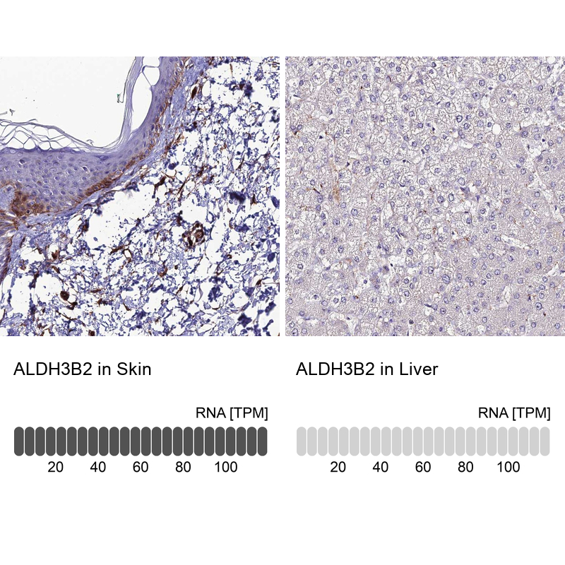 Anti-ALDH3B2 Antibody
