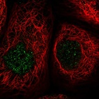 Immunofluorescent staining of human cell line A-431 shows localization to nucleoplasm.