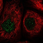 Anti-MCM8 Antibody