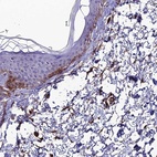 Immunohistochemical staining of human skin shows high expression.