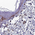 Immunohistochemical staining of human skin shows high expression.