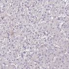 Immunohistochemical staining of human liver shows low expression as expected.