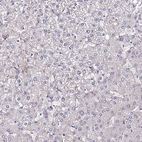 Immunohistochemical staining of human liver shows low expression as expected.