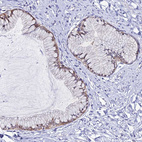 Anti-ZMIZ1 Antibody