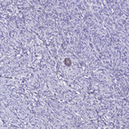 Anti-ZMIZ1 Antibody