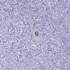 Immunohistochemical staining of human ovary shows moderate cytoplasmic positivity in follicle cells.