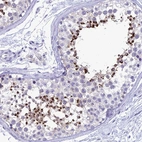 Immunohistochemical staining of human testis shows strong cytoplasmic positivity in spermatids.